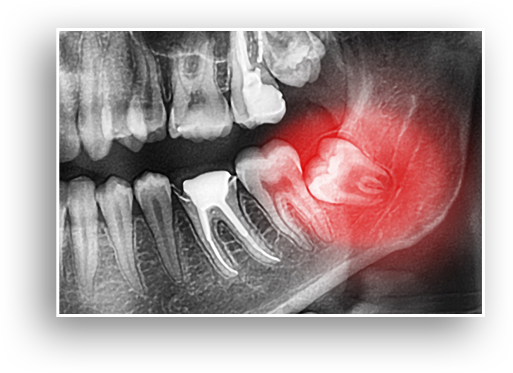 Common Dental Problems Village Dental Group