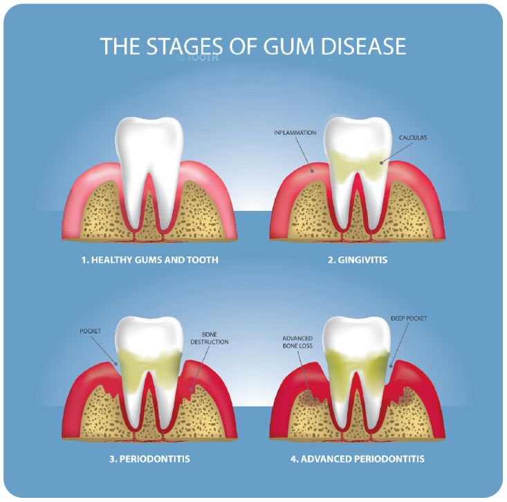 Oral Health – Village Dental Group