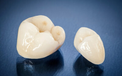 Why Does My Tooth Hurt After a Filling or Crown?