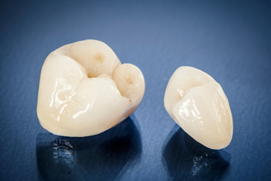 dental crowns photograph of porcelain dental crowns